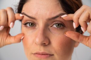 Close-up of a woman holding her eyes open to show that she needs PRK treatment to improve her eyesight.